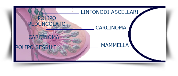 linfonodi